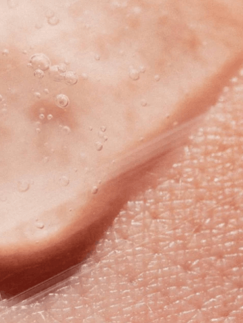 Olievrije zinkgezichtsgel voor mannen 15 ml